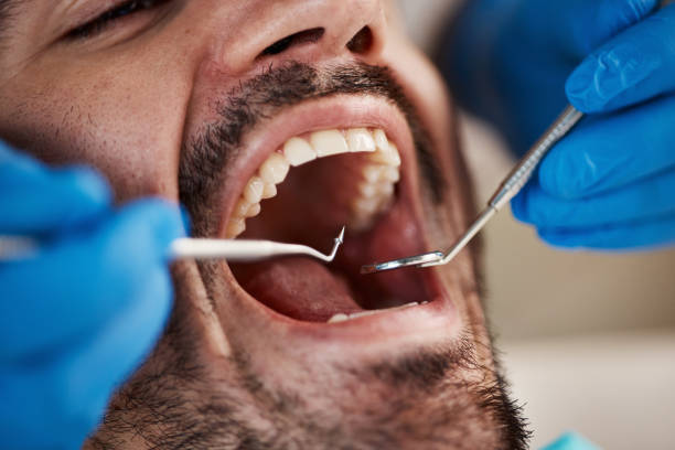 Best Urgent Tooth Repair  in Tarrant, AL